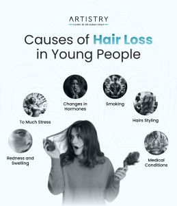 Causes of Hair Loss in Young People