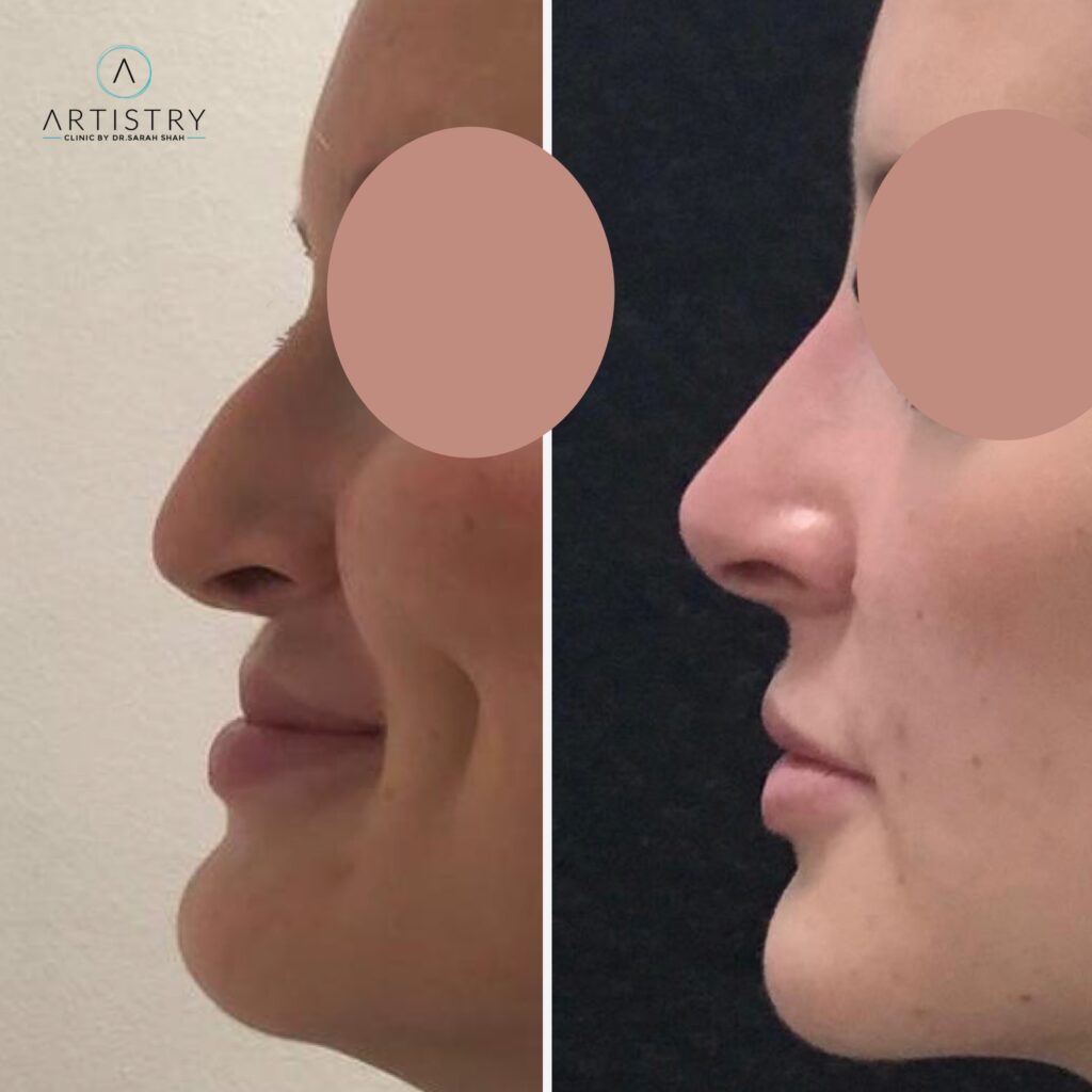 Before & After Image