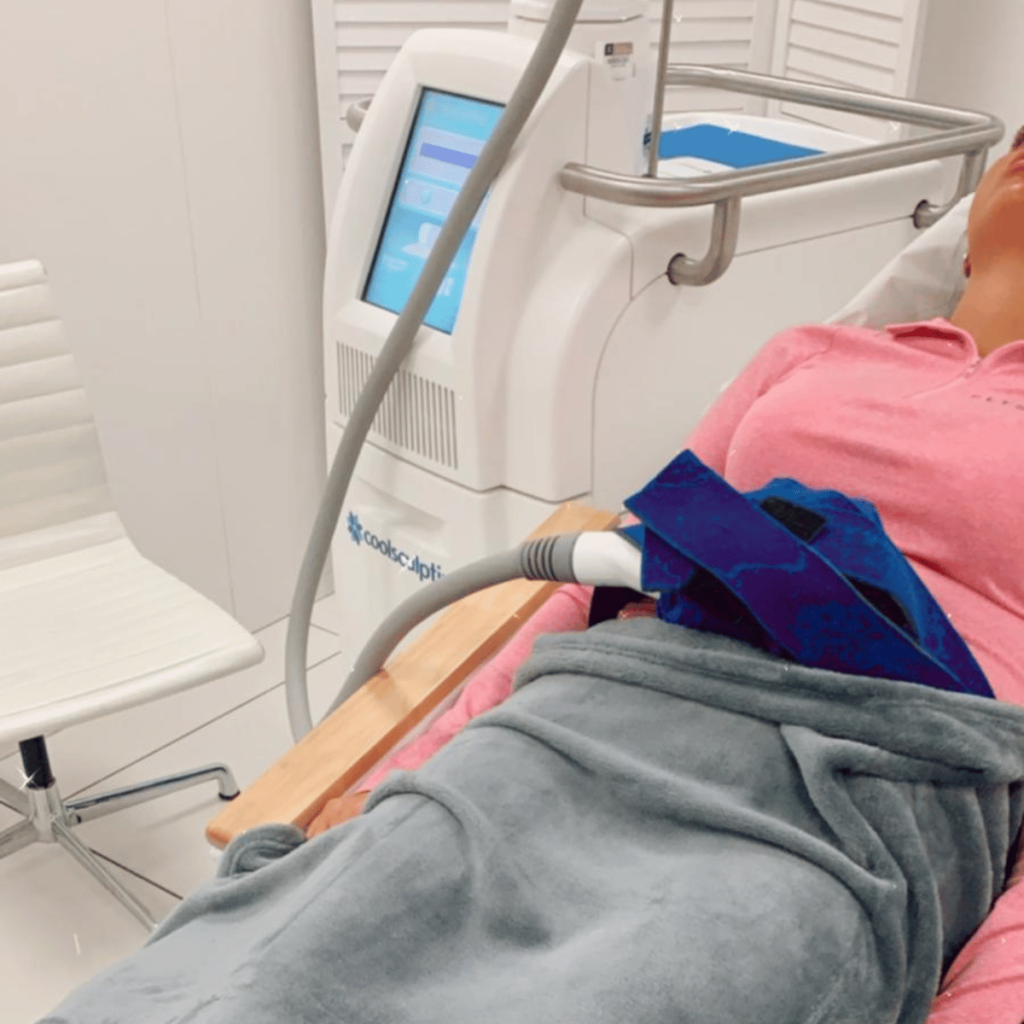Coolsculpting at Artistry Clinic