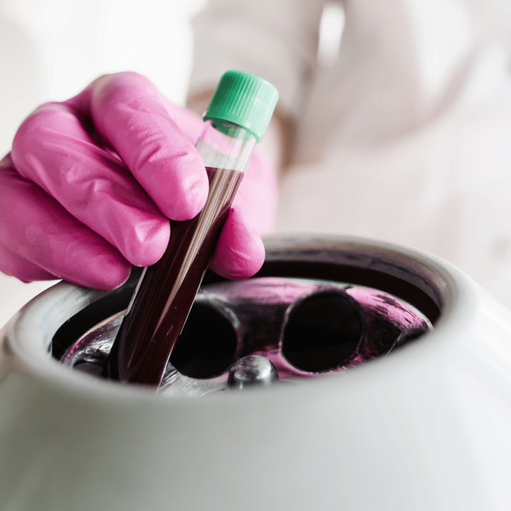 Close-up inserting test tube with blood in a centrifuge to get plasma for a PRP treatment.