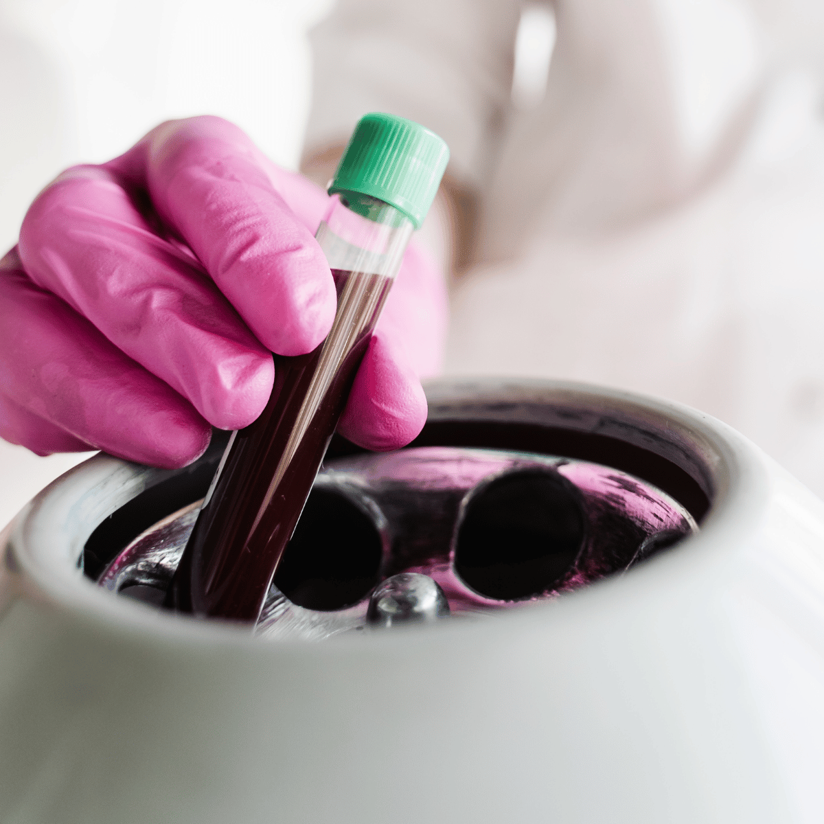 Close-up inserting test tube with blood in centrifuge to get plasma of patient girl for PRP