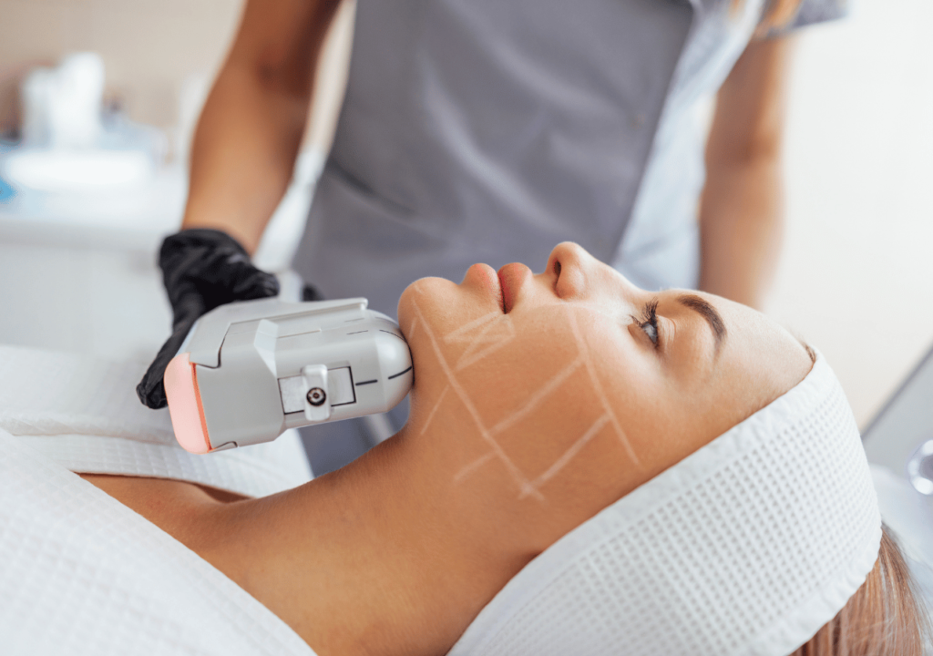 woman having HIFU done on her chin