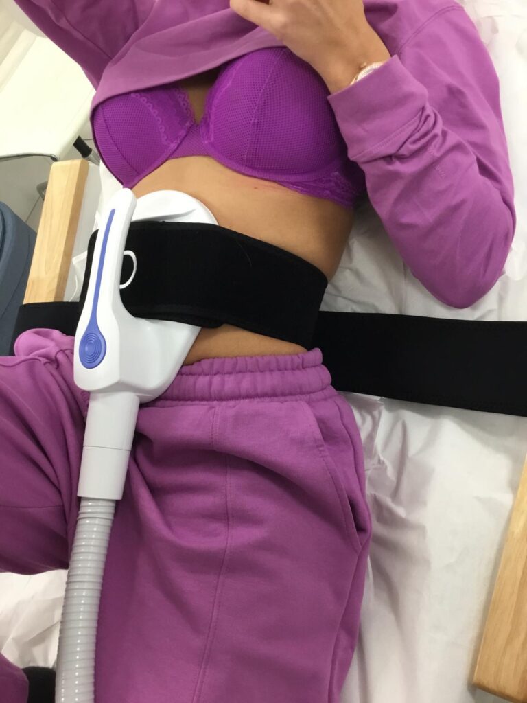 A woman has high-intensity electromagnetic muscle training for body contouring.