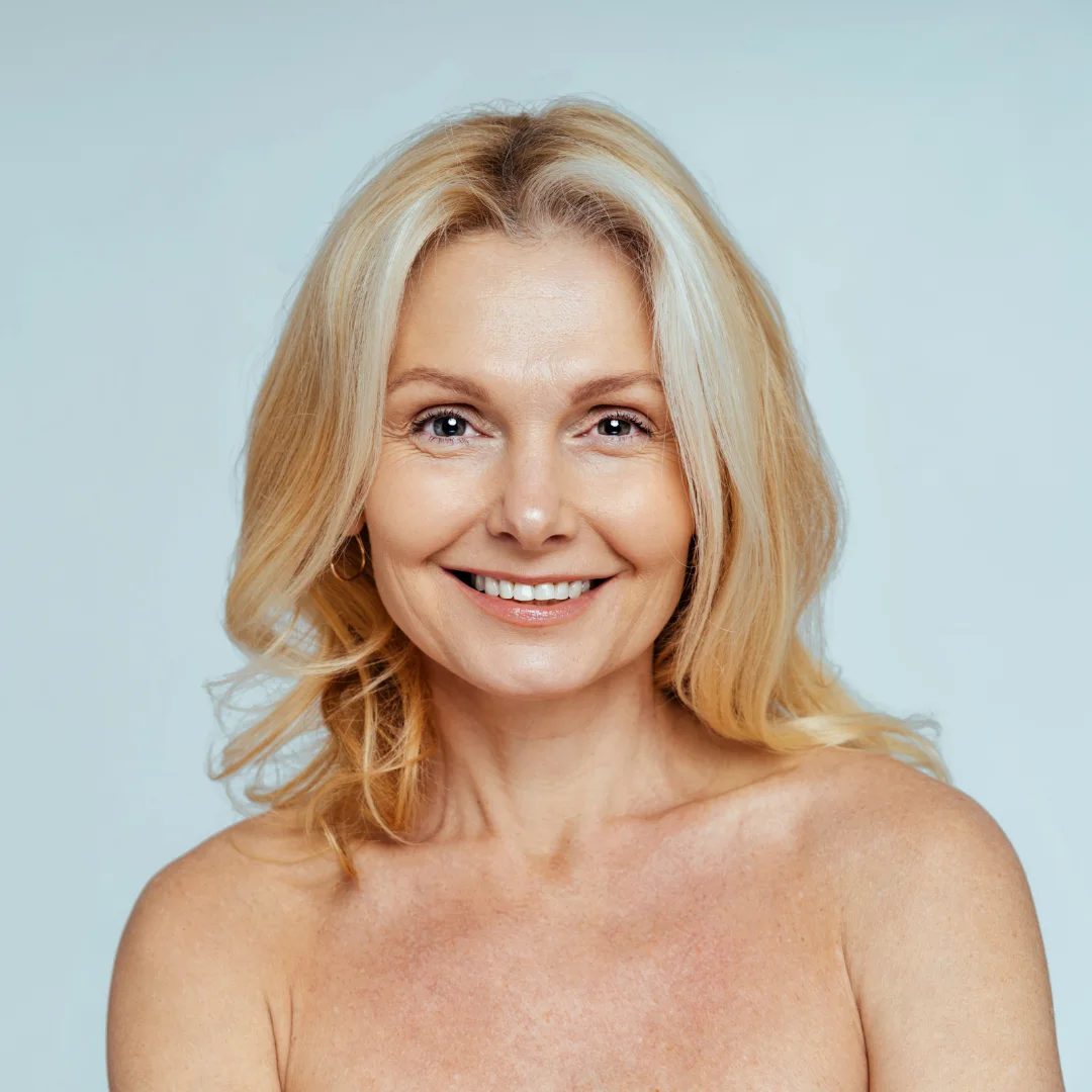 middle age woman after Skin Resurfacing