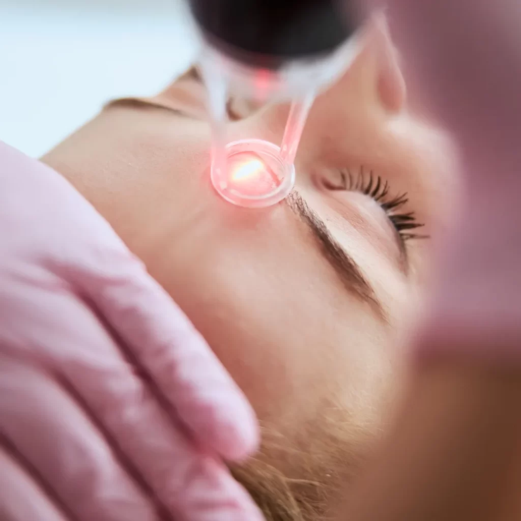 woman having ultraclear laser treatment