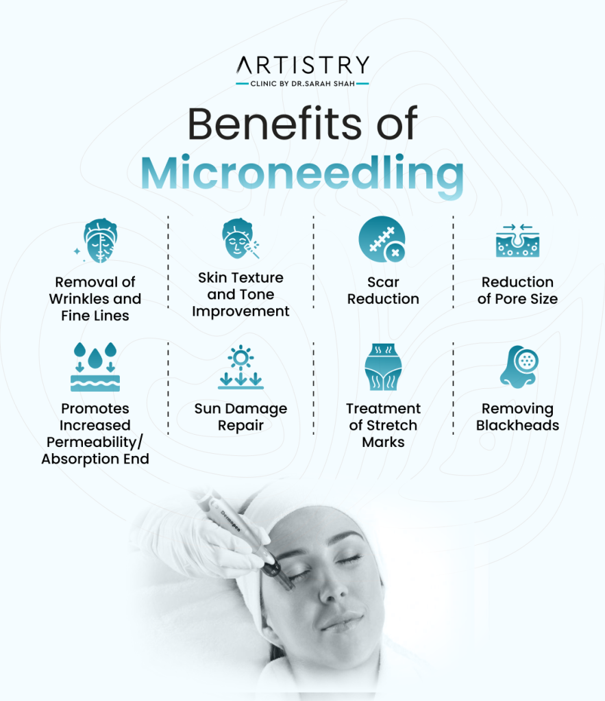 Top Benefits of Microneedling