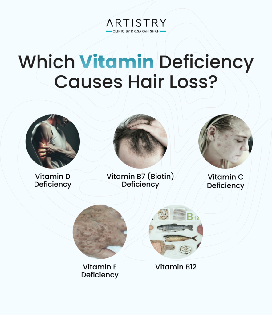 Common Vitamin Deficiencies That Cause Hair Loss