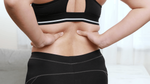 how to get rid of back fat