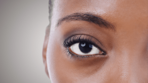 Dark Eyelids