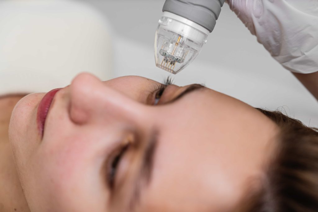 Dark Eyelids Treatment