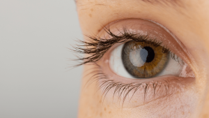 How to Remove Dark Circles Under Eyes Permanently