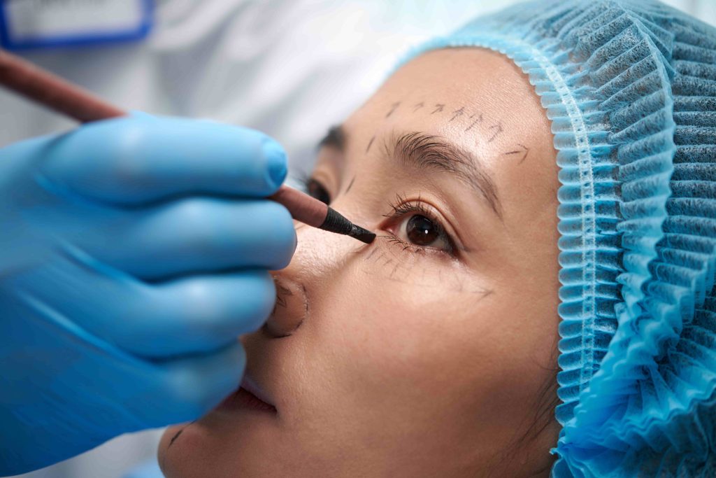 dark circles remove permanently