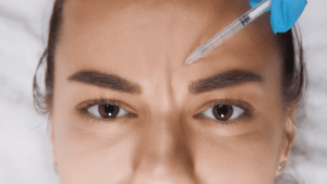 Botox for Eyebrow Lift