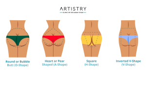 Different Butt Shapes