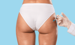 How Long Do Butt Injections Last