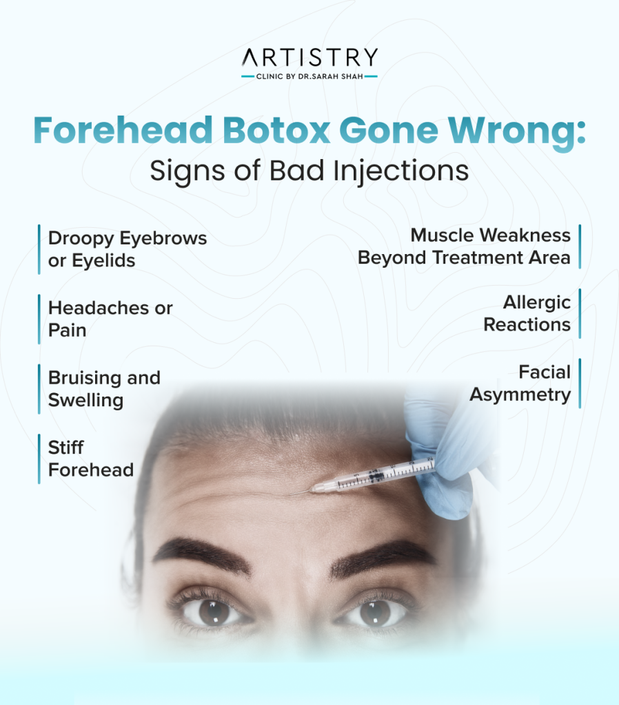 botox forehead gone wrong