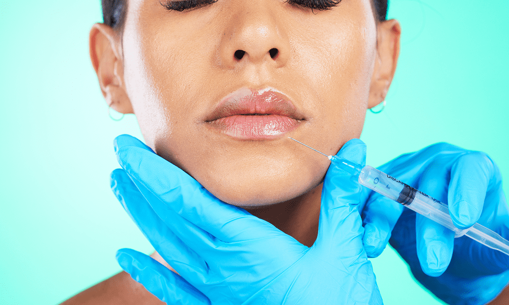 lip flip botox