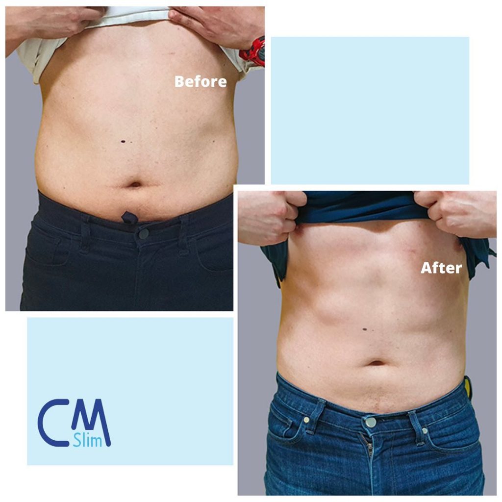 how do i get rid of belly fat
