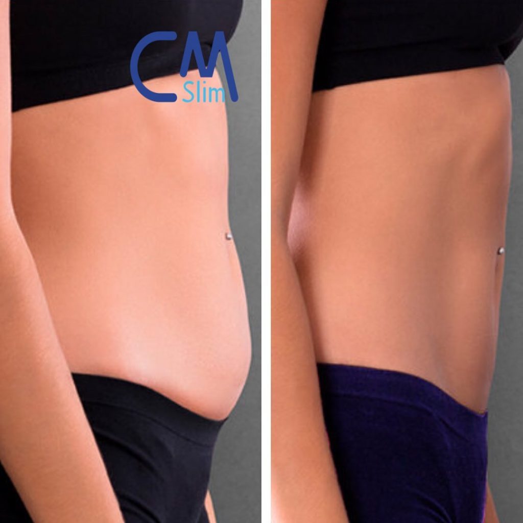 how to get rid of lower belly fat