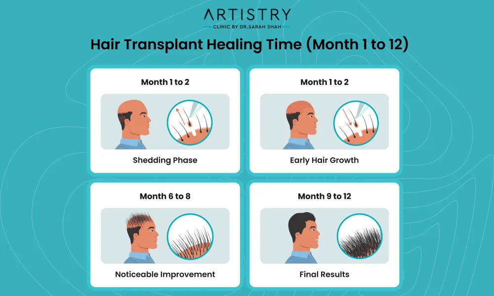 Hair Transplant Recovery Timeline What To Expect